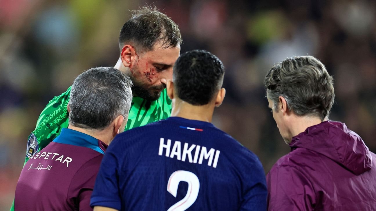 PSG keeper Donnarumma bloodied by cleat to the face
