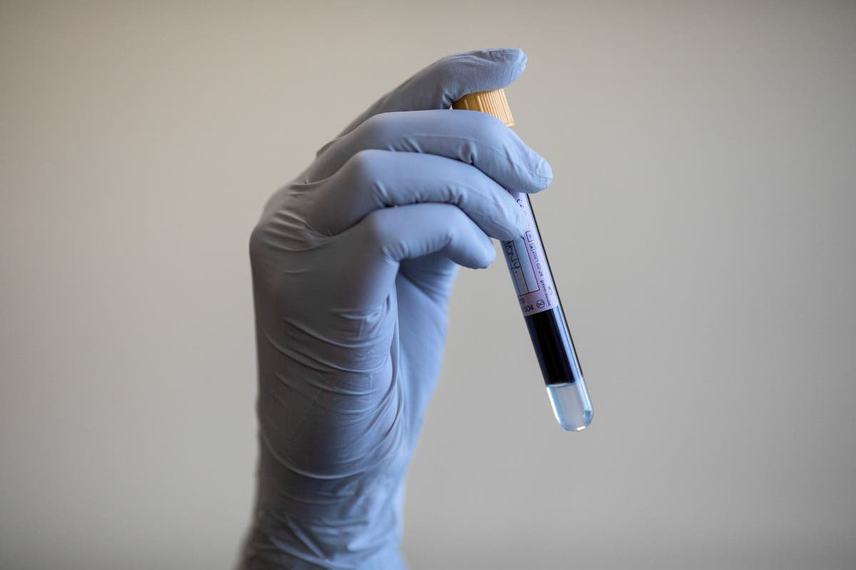 What you can eat five times a week to fight type 2 diabetes, according to scientists What you can eat five times a week to fight type 2 diabetes, according to scientists