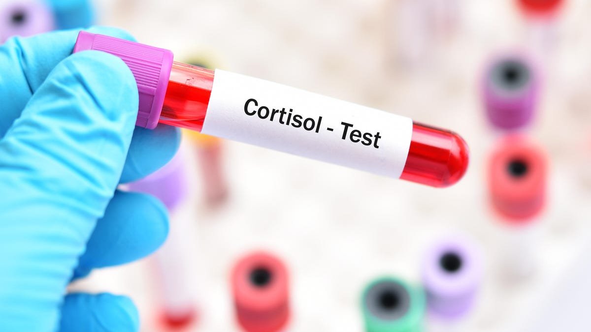 I Got a Blood Stress Test to Learn More About Cortisol and Its Effects on Our Bodies