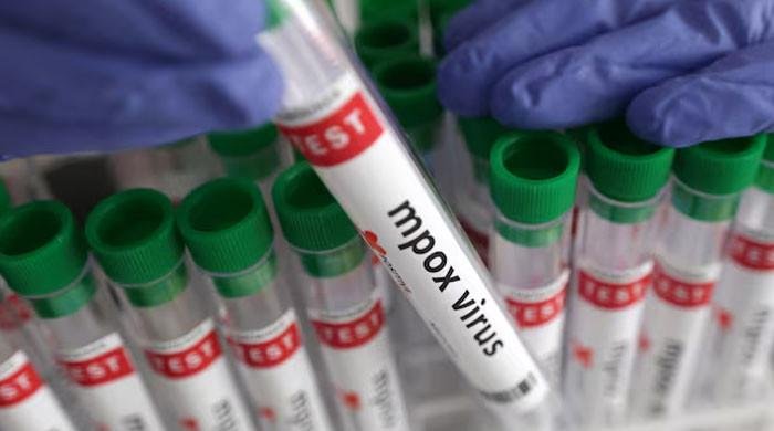 UAE reports first case of new clade 1b mpox, says WHO UAE reports first case of new clade 1b mpox, says WHO