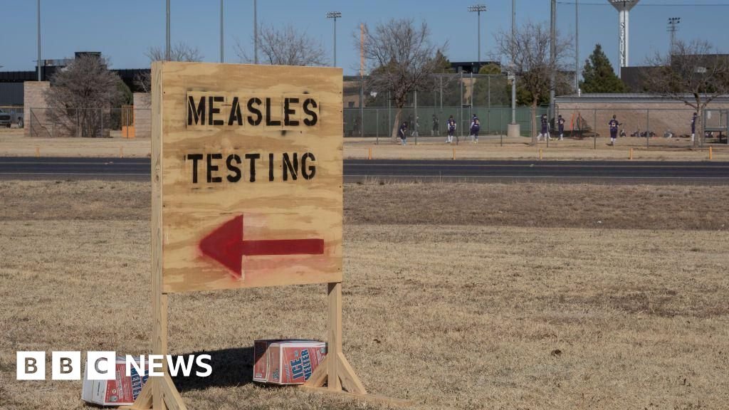 Second child dies of measles as western Texas outbreak worsens Second child dies of measles as western Texas outbreak worsens