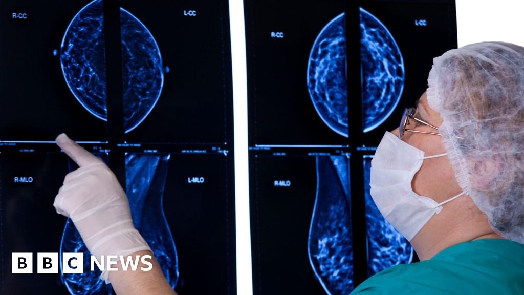 New pill can slow progression of incurable breast cancer New pill can slow progression of incurable breast cancer