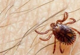 Two doctors at Karachi’s Jinnah Hospital exhibit suspected symptoms of Congo virus