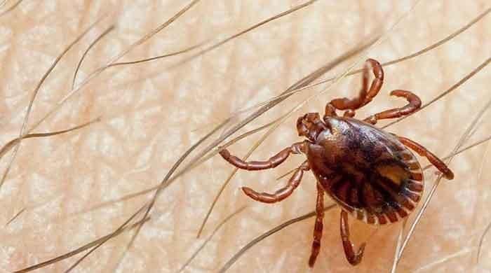 Two doctors at Karachi’s Jinnah Hospital exhibit suspected symptoms of Congo virus Two doctors at Karachi’s Jinnah Hospital exhibit suspected symptoms of Congo virus