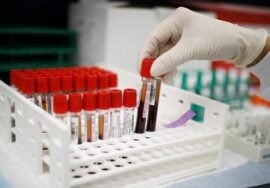 French scientists find new blood type in Guadeloupe woman