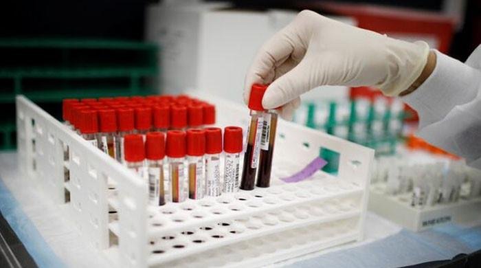 French scientists find new blood type in Guadeloupe woman French scientists find new blood type in Guadeloupe woman