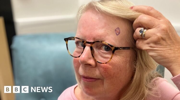 Digital imaging service slashes waits for skin cancer checks Digital imaging service slashes waits for skin cancer checks