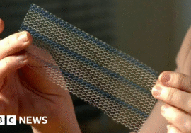 Women’s health campaigners want results for pelvic mesh victims