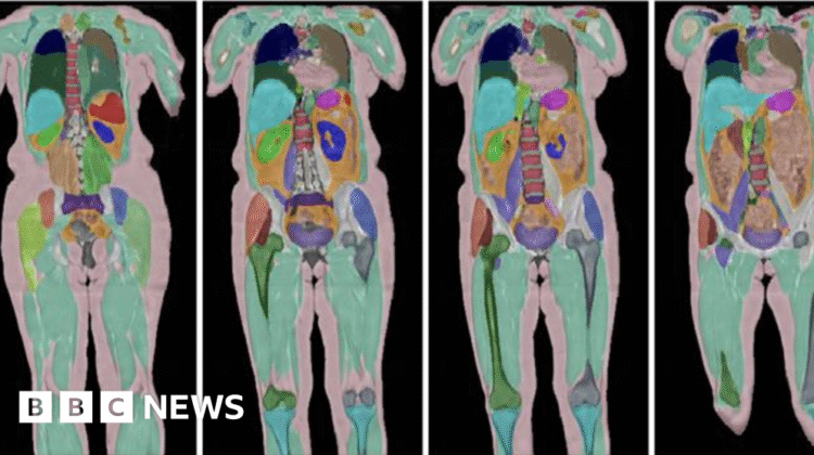 Biggest human imaging study scans 100,000th UK volunteer Biggest human imaging study scans 100,000th UK volunteer