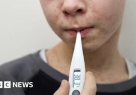 Why are measles cases rising in the UK and who can get the MMR vaccine?