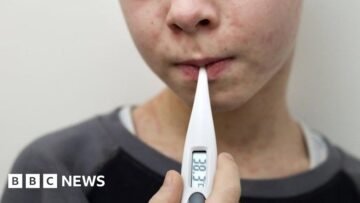 Why are measles cases rising in the UK and who can…