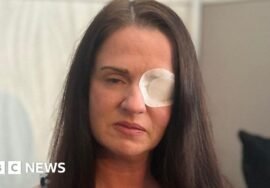 County Durham women fall ill as fake Botox beautician apologises