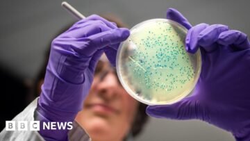 AI designs new superbug-killing antibiotics for go…