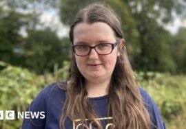 Amy has complex PTSD but has seen a psychiatrist once in 10 years